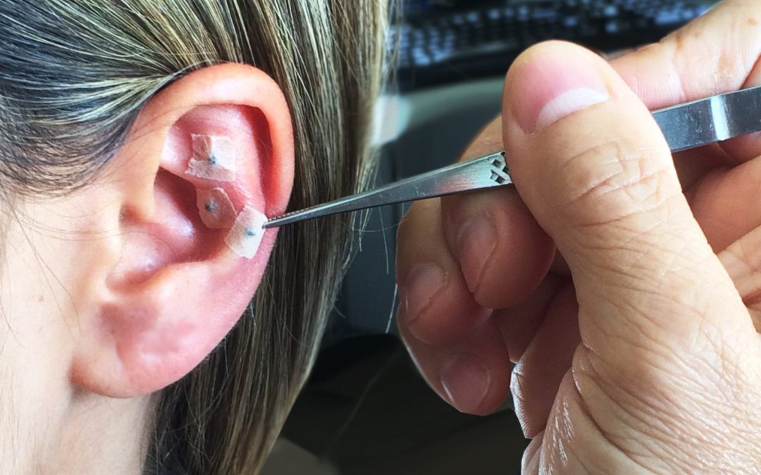 Pedras quentes sobre toalha branca